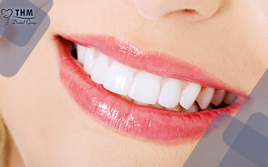 Bọc răng sứ - Giải pháp hoàn hảo cho nụ cười rạng rỡ