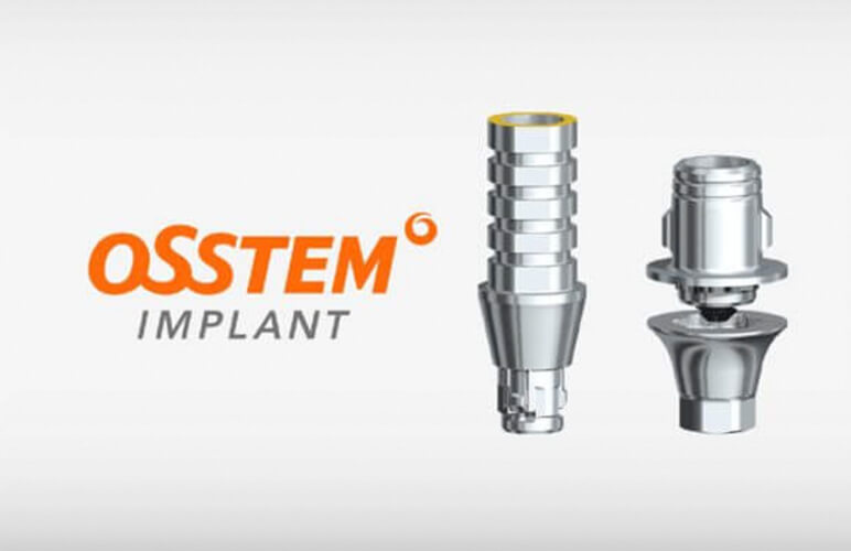 Trụ Implant Osstem Có Xuất Xứ Và Giá Cả Như Thế Nào?